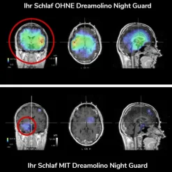 Dreamolino Mehr Komfort Im Alltag-Night Guard Bettüberzug zum Schutz vor Elektrosmog