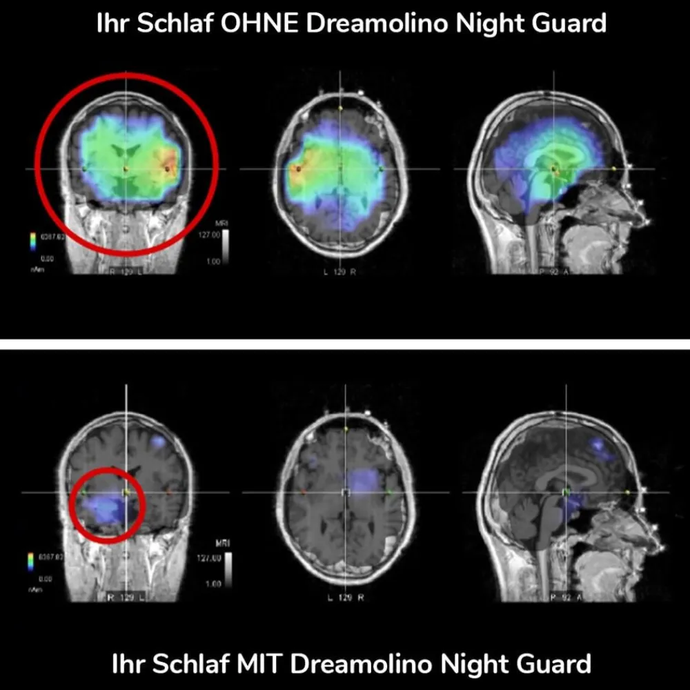 Dreamolino Mehr Komfort Im Alltag-Night Guard Bettüberzug zum Schutz vor Elektrosmog