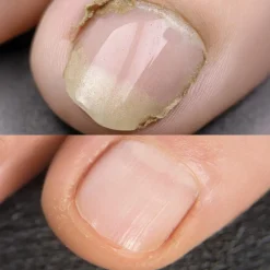 Keine Körperpflege & Hygiene-IZA Effect Anti Fuß- & Nagelpilz Spray 1+1 GRATIS