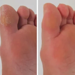 Mediashop.tv Nützliche Helfer Für Das Beste Alter|Körperpflege & Hygiene-PediVac elektrischer Hornhautentferner mit Saugfunktion 1+1 GRATIS