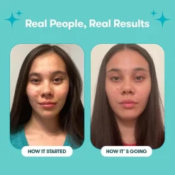Proactiv Körperpflege & Hygiene|Kosmetik-Gentle 30 Tage Routine 120 ml + 30 Zits Happen Patches