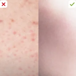 Velform Körperpflege & Hygiene|Kosmetik-Epilwiz Epilierer inkl. 7tlg. Manikürset