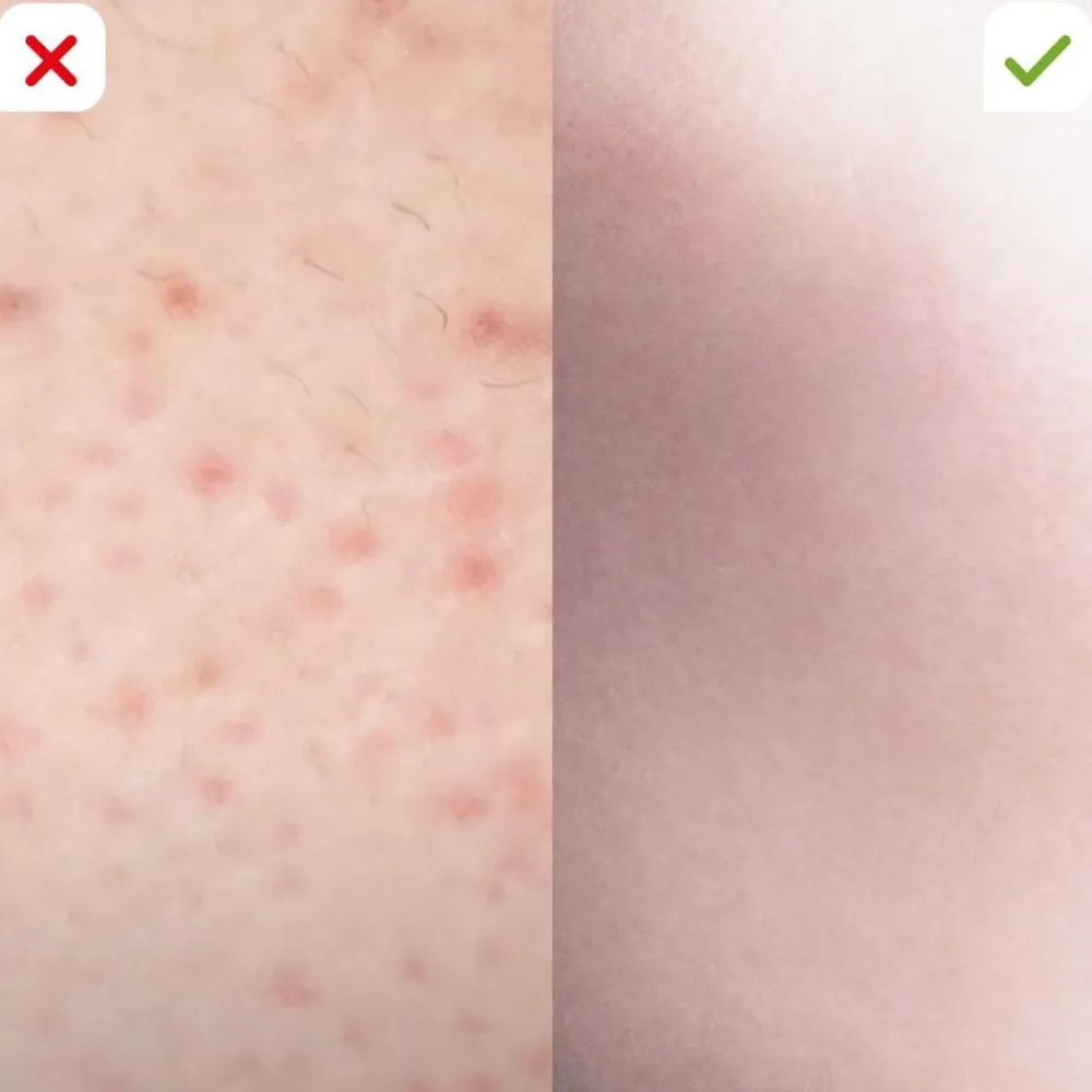 Velform Körperpflege & Hygiene|Kosmetik-Epilwiz Epilierer inkl. 7tlg. Manikürset
