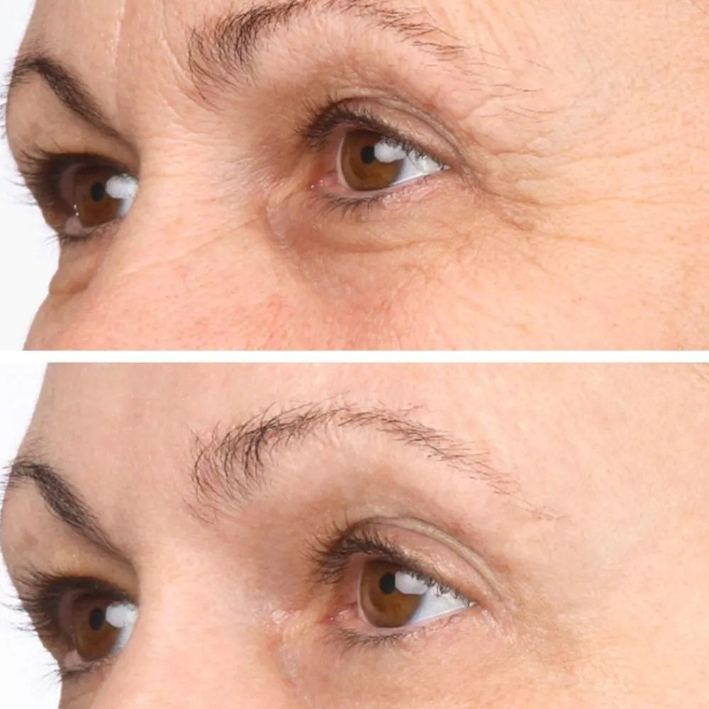Vitame Gesundheit & Wohlbefinden|Kosmetik-Collagen Plus by Joachim Kaeser 90 Kapseln 1+1 GRATIS