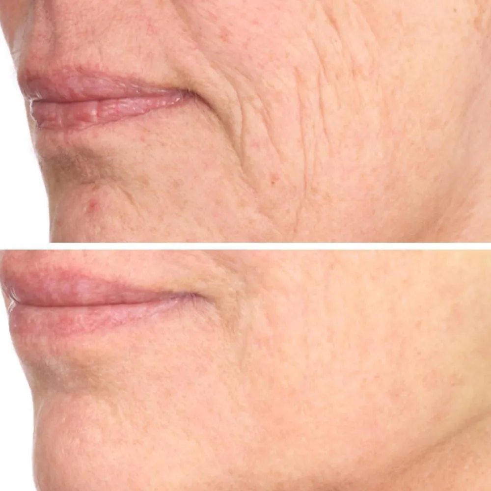 Vitame Gesundheit & Wohlbefinden|Kosmetik-Collagen Plus by Joachim Kaeser 90 Kapseln 1+1 GRATIS